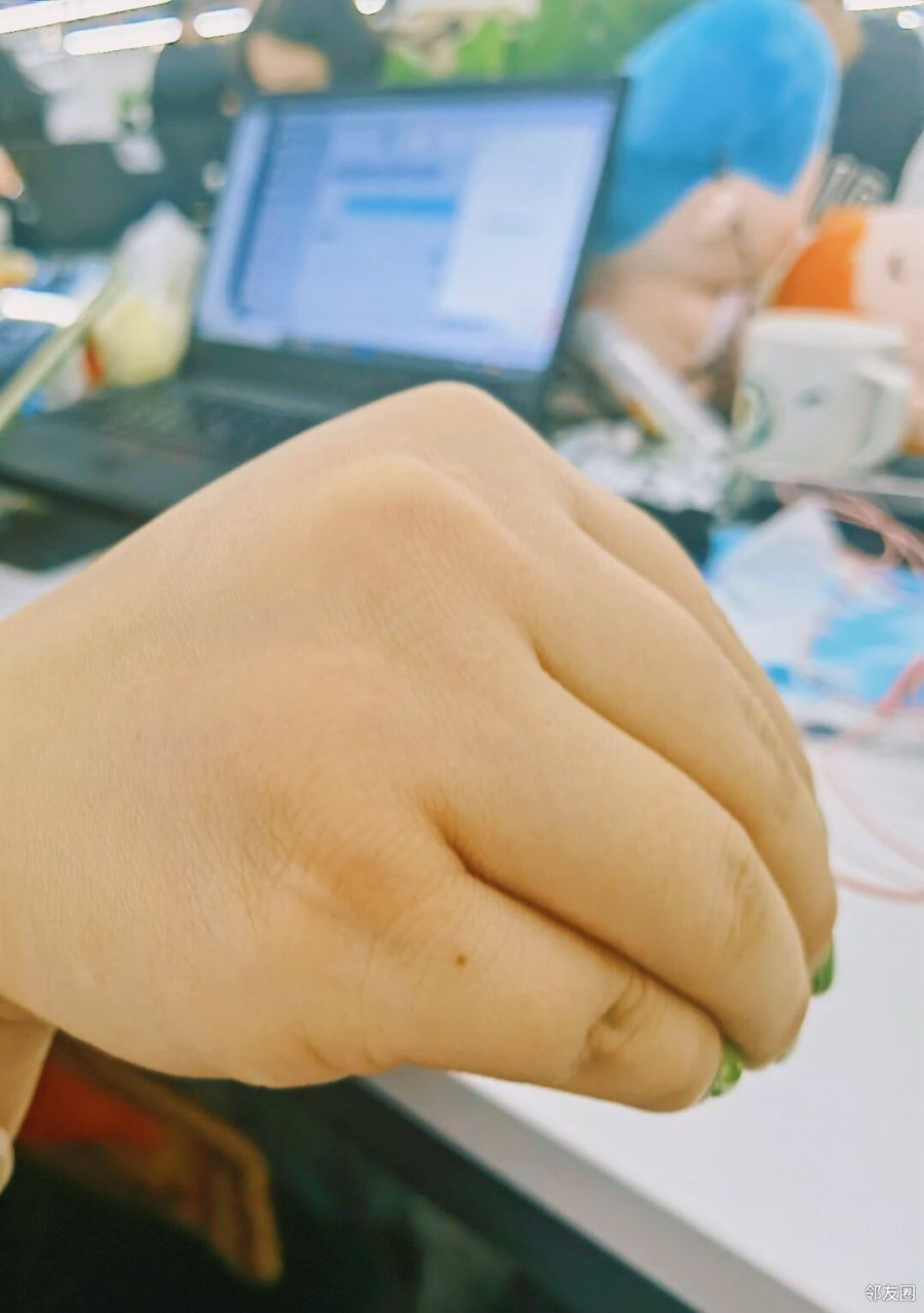 同事一直在问我她的手像不像猪蹄67676767676767我该