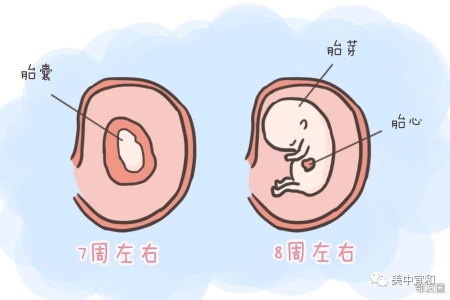 还能监测有无胎心搏动及卵黄囊等,及时发现胚胎发育的异常情况